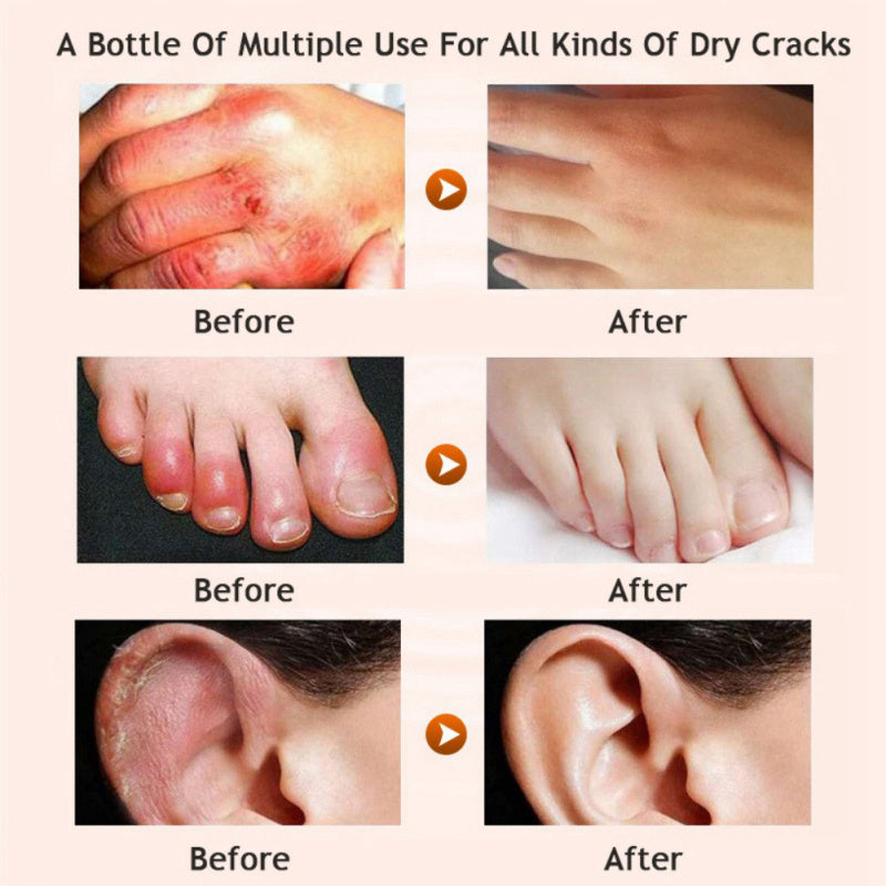 Honey moisturizing cream foot