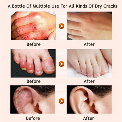 Honey moisturizing cream foot